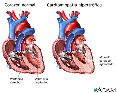 imagine cu cardiomiopatia 